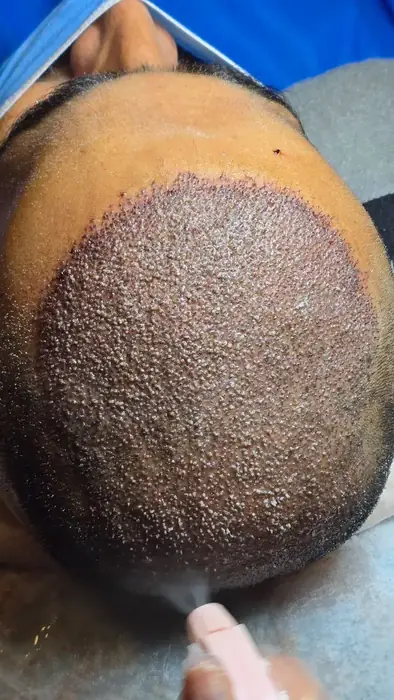 استخدام پزشک متخصص پوست و مو جهت درمانگاه تخصصی پوست و مو در چابهار