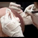 استخدام چند نفر تکنسین ثابت جهت مجموعه‌ معتبر کاشت مو در شیراز