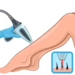 استخدام اپراتور لیزر جهت کلینیک در مرکز شهر رودهن تهران