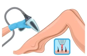 استخدام اپراتور لیزر جهت کلینیک در مرکز شهر رودهن تهران