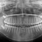 فروش دستگاه رادیولوژی OPG پانورامیک در اهواز