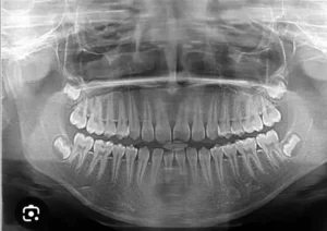 فروش دستگاه رادیولوژی OPG پانورامیک در اهواز