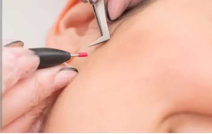 استخداماپراتور لیزر و پزشک به عنوان مسئول فنی مطب زیبایی در شرق تهران