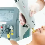 استخدام اپراتور لیزر خانم در قرچک