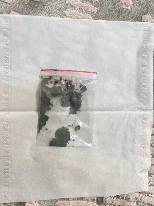 خرید پسماند آمالگام دندانپزشکی در تهران