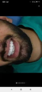 استخدام بازاریاب و ویزیتور دندانپزشکی جهت کلینیک در تبریز