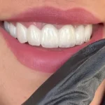 استخدام منشی و دستیار دندانپزشک جهت شیفت بعدازظهر کلینیک معتبر در ارومیه