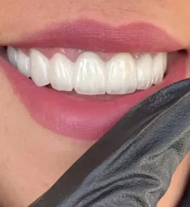 استخدام منشی و دستیار دندانپزشک جهت شیفت بعدازظهر کلینیک معتبر در ارومیه