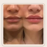 استخدام پزشک عمومی آشنا به خدمات زیبایی جهت کلینیک زیبایی در تهران