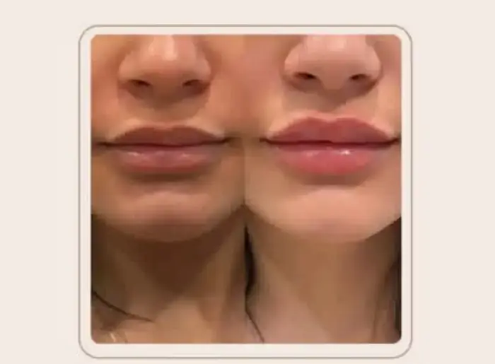 استخدام پزشک عمومی آشنا به خدمات زیبایی جهت کلینیک زیبایی در تهران