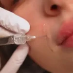 استخدام پزشک عمومی مسلط به امور زیبایی جهت مطب زیبایی واقع در اندرزگو تهران