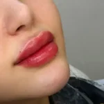 استخدام پزشک خانم جهت کلنیک زیبایی فعال در قزوین