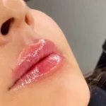 استخدام پزشک عمومی جهت مرکز زیبایی در تبریز