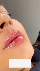 استخدام پزشک عمومی جهت مرکز زیبایی در تبریز