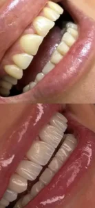 استخدام دندانپزشک زیبایی مجرب جهت مطب شخصی در شهرقدس تهران