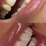 استخدام دندانپزشک زیبایی مجرب جهت مطب شخصی در شهرقدس تهران