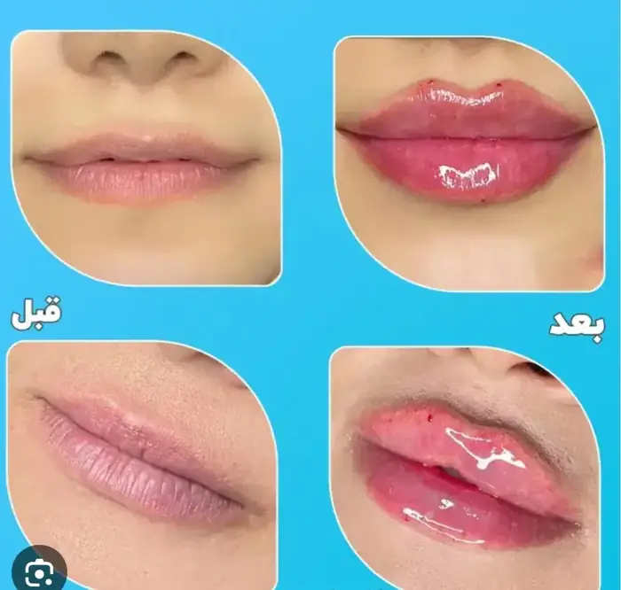 استخدام دستیار و منشی پزشک زیبایی در طرشت تهران