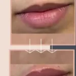 استخدام دستیار خانم باسابقه برای همکاری با پزشک پوست و مو در سعادت‌آباد تهران