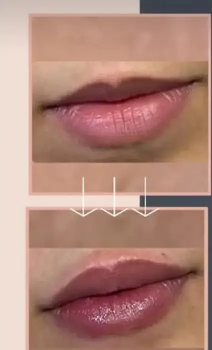 استخدام دستیار خانم باسابقه برای همکاری با پزشک پوست و مو در سعادت‌آباد تهران