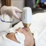 استخدام اپراتور لیزر باتجربه جهت مرکز فعال در رشت