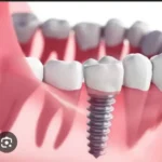 استخدام منشی و دستیار دندانپزشک جهت مطب معتبر در سنندج