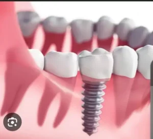 استخدام منشی و دستیار دندانپزشک جهت مطب معتبر در سنندج