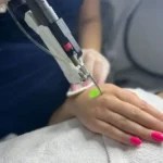 استخدام اپراتور لیزر و منشی جهت کلینیک زیبایی در اراک