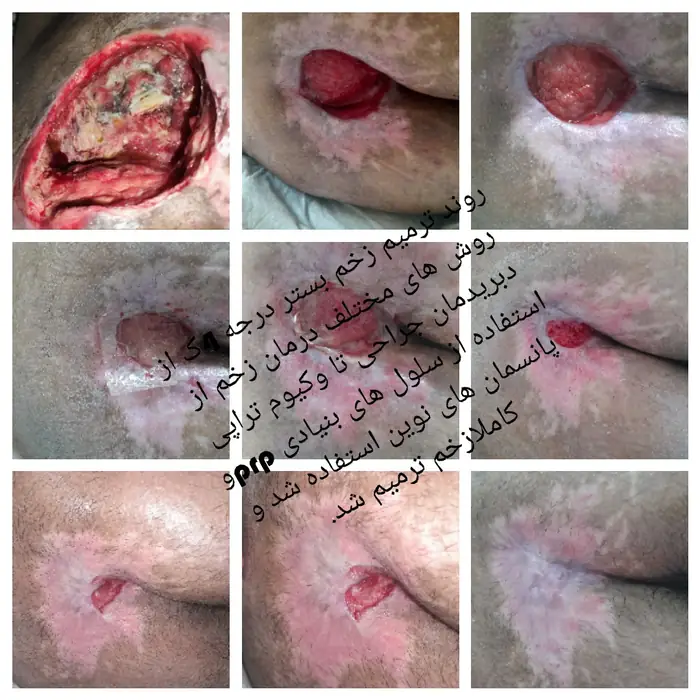 استخدام درمانگر زخم جهت کلینیک تخصصی در تهران