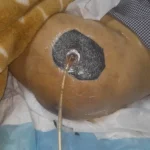 استخدام درمانگر زخم جهت کلینیک تخصصی در تهران