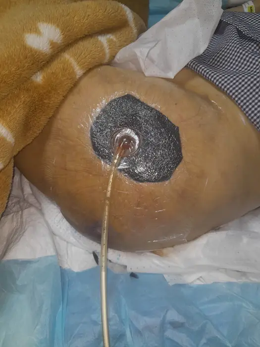 استخدام درمانگر زخم جهت کلینیک تخصصی در تهران