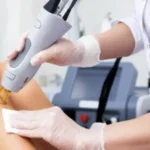 استخدام اپراتور لیزر جهت مطب زیبایی معتبر در تهران