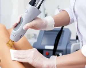 استخدام اپراتور لیزر جهت مطب زیبایی معتبر در تهران