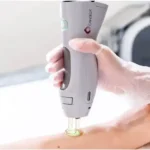 استخدام اپراتور لیزر آقا جهت مرکز زیبایی فعال در شرق تهران