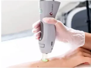 استخدام اپراتور لیزر آقا جهت مرکز زیبایی فعال در شرق تهران