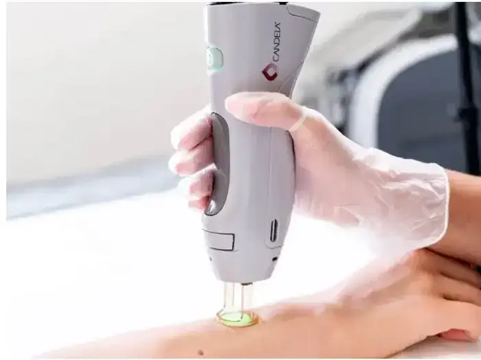 استخدام اپراتور لیزر آقا جهت مرکز زیبایی فعال در شرق تهران