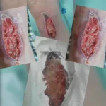 استخدام درمانگر زخم جهت کلینیک تخصصی در تهران