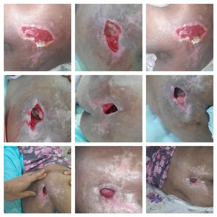 استخدام درمانگر زخم جهت کلینیک تخصصی در تهران