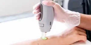 استخدام اپراتور لیزر جهت کلینیک زیبایی در یاسوج