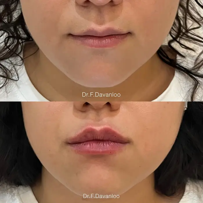 پزشک عمومی هستم دارای پروانه و مسلط به امور زیبایی آماده همکاری با کلینیک‌های فعال در تهران