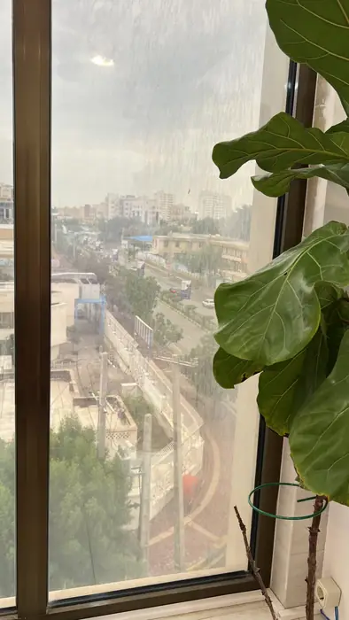 واگذاری کلینیک زیبایی و لیزر با تجهیزات کامل در بندرعباس