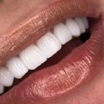 استخدام نیروی خدماتی جهت کلینیک دندانپزشکی در الهیه تهران