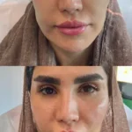 پزشک عمومی هستم دارای پروانه و مسلط به امور زیبایی آماده همکاری با کلینیک‌های فعال در تهران