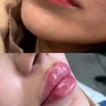 پزشک عمومی هستم دارای پروانه و مسلط به امور زیبایی آماده همکاری با کلینیک‌های فعال در تهران