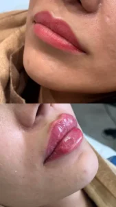 پزشک عمومی هستم دارای پروانه و مسلط به امور زیبایی آماده همکاری با کلینیک‌های فعال در تهران