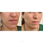 پزشک عمومی هستم دارای پروانه و مسلط به امور زیبایی آماده همکاری با کلینیک‌های فعال در تهران