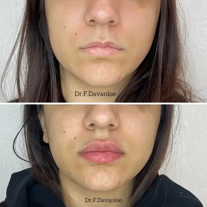 پزشک عمومی هستم دارای پروانه و مسلط به امور زیبایی آماده همکاری با کلینیک‌های فعال در تهران