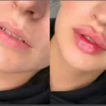 پیراپزشک هستم آماده همکاری با کلینیک های زیبایی در تهران