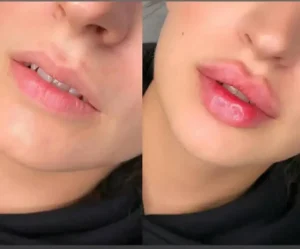 پیراپزشک هستم آماده همکاری با کلینیک های زیبایی در تهران