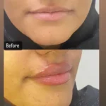 پزشک عمومی هستم دارای پروانه آماده همکاری با کلینیک های زیبایی و درمانی در کرمان