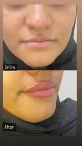 پزشک عمومی هستم دارای پروانه آماده همکاری با کلینیک های زیبایی و درمانی در کرمان